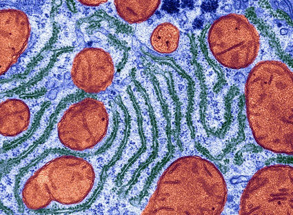 Image: Color enhanced transmission electron micrograph (TEM) of the liver of a normal hamster showing the endoplasmic reticulum (photo courtesy Don W. Fawcett / Science Photo Library).